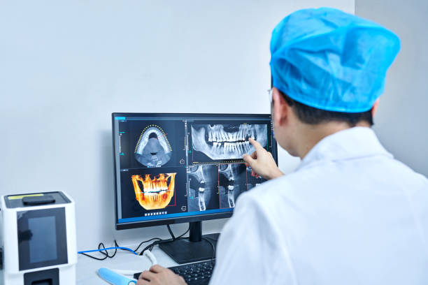 Best Emergency Wisdom Teeth Removal in Felton, CA